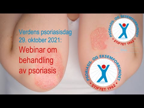 Video: Psykosomatik til psoriasis og hvordan man behandler det hos voksne