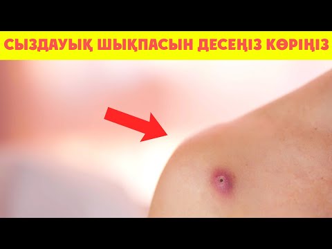 Бейне: YouTube -те жазылушыларды алудың 3 әдісі