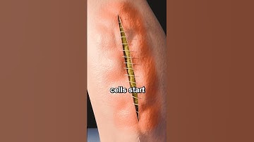 What happens when you get stitches? #viral #facts #youtubeshorts #trendingshorts