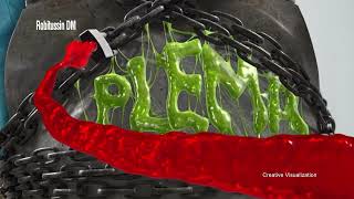 Shackles Freight 15s