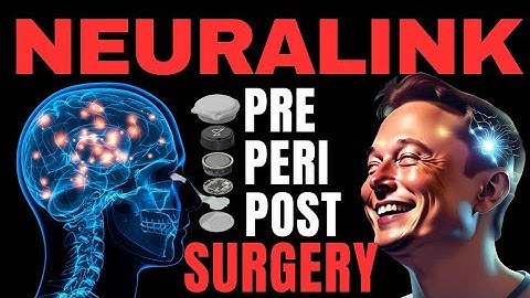 NEURALINK: Surgery procedure STEP-BY-STEP 🧠 #ai #elonmusk #neuralink