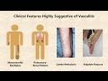 Vasculitis - An Overview