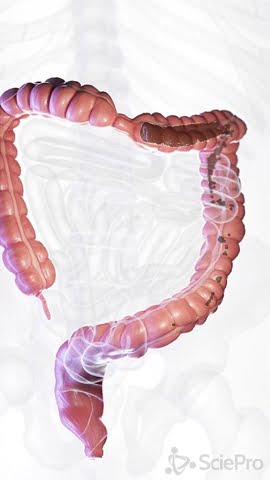 💧 Understanding Diarrhea: Causes and Care 💧  #anatomy #meded #3danimation