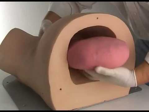 Video: Zadržená Placenta U Psů - Zadržená Placenta