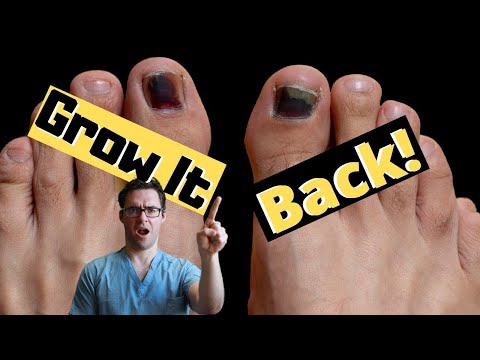 Видео: Хөлийн хумс унахаас хэрхэн сэргийлэх вэ?