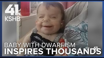 Baby born with rare form of dwarfism defies odds, inspires thousands