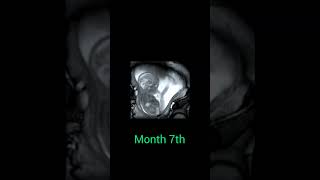 viralshorts2023/pregnanctfactsquickening baby activity in mother womb/live pregnancy scan