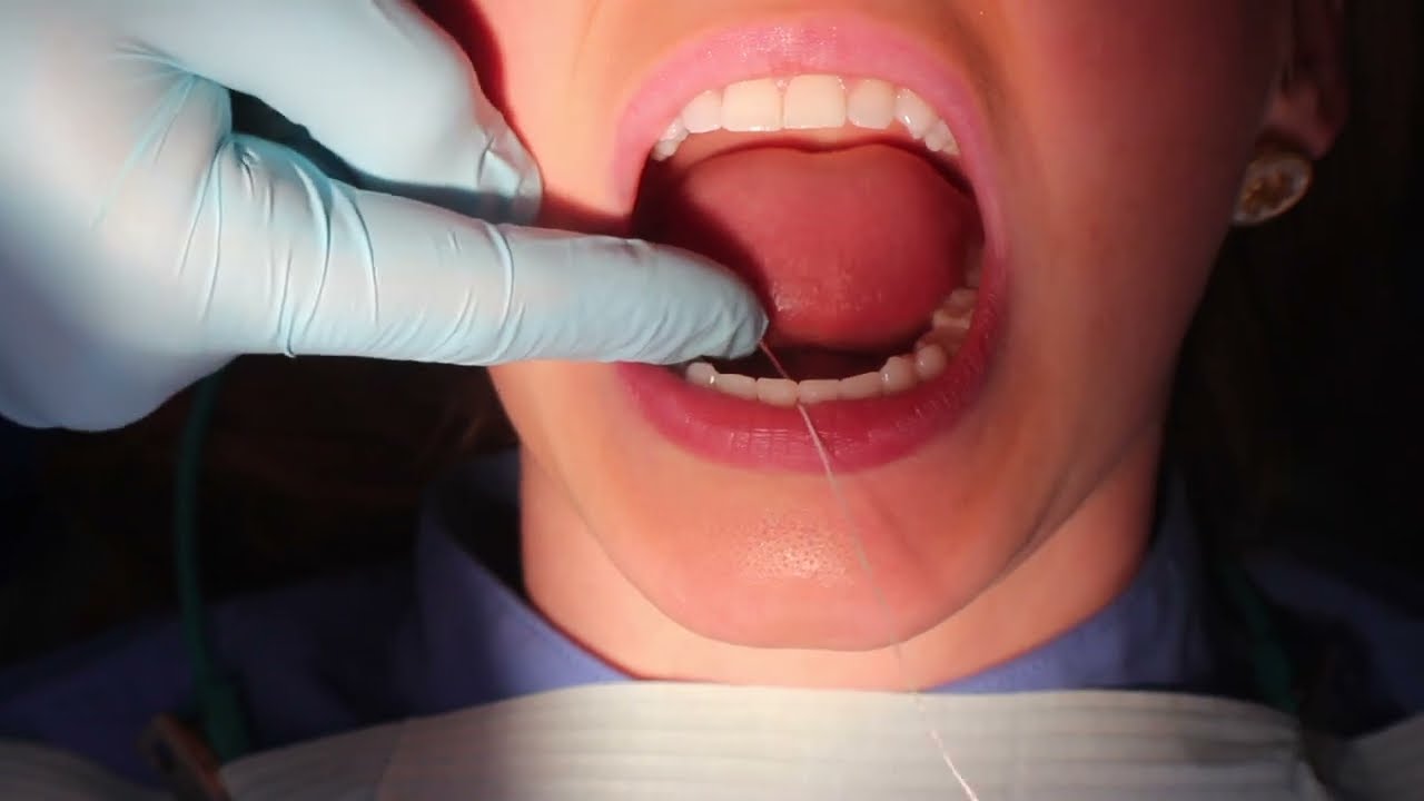 How to Properly Floss - YouTube