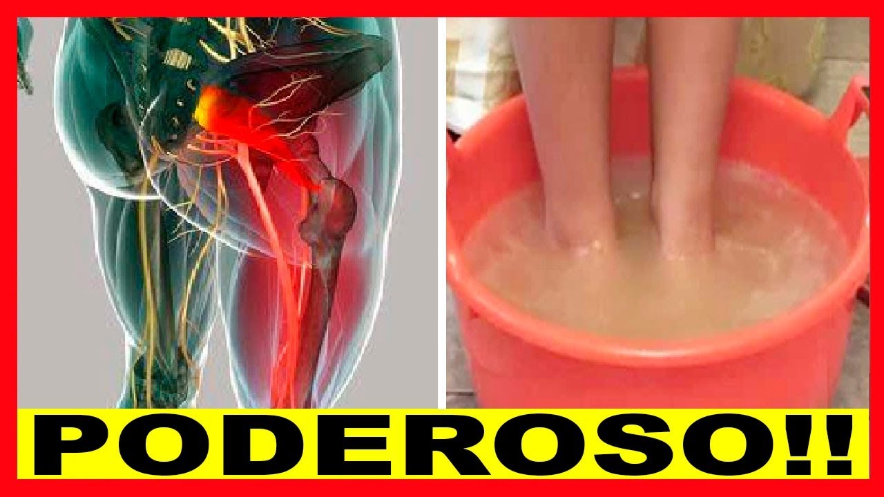 Melhor Remédio Para Nervo Ciático Inflamado