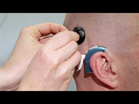 HiRes™ Ultra 3D Cochlear Implant Magnet and Headpiece Assembly [EN captions]