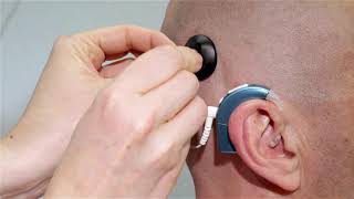 HiRes™ Ultra 3D Cochlear Implant Magnet and Headpiece Assembly [EN captions]