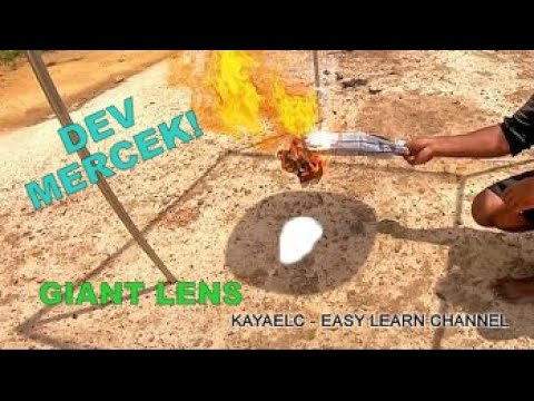 Akıllı Mercek Nedir, Kimlere Takılır ve Akıllı Mercek Ameliyatı Nasıl Yapılır?|Doç. Dr. Berkay Akmaz