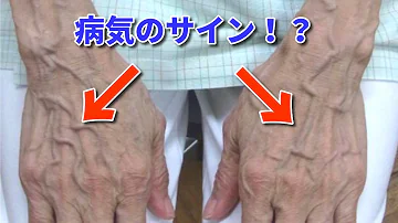 تحميل 血管をバキバキにする方法 Mp4 Mp3