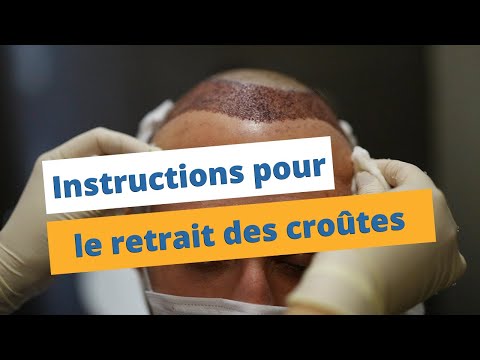 Vidéo: Est-ce que les croûtes tombent ?