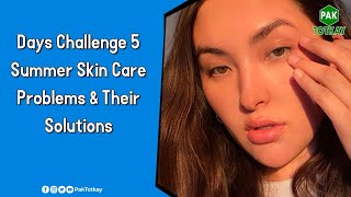 5 Days Challenge Summer Skin Care Problems & Their Solutions | #paktotkay