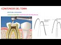 "PREPARACIÓN BIOMECÁNICA" y apertura coronaria Endodoncia