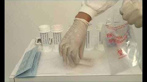 Transport of FNA samples