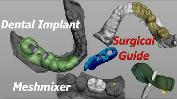 Surgical Guide using - Meshmixer