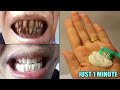 how to whiten your teeth | Teeth Whitening At Home In 3 Minutes 100% Effective| Whiten Yellow Teeth