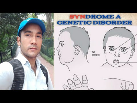 Hemophilia A genetic disorder disease ( हेमोफिलिया एक आनुवंशिक रोग)