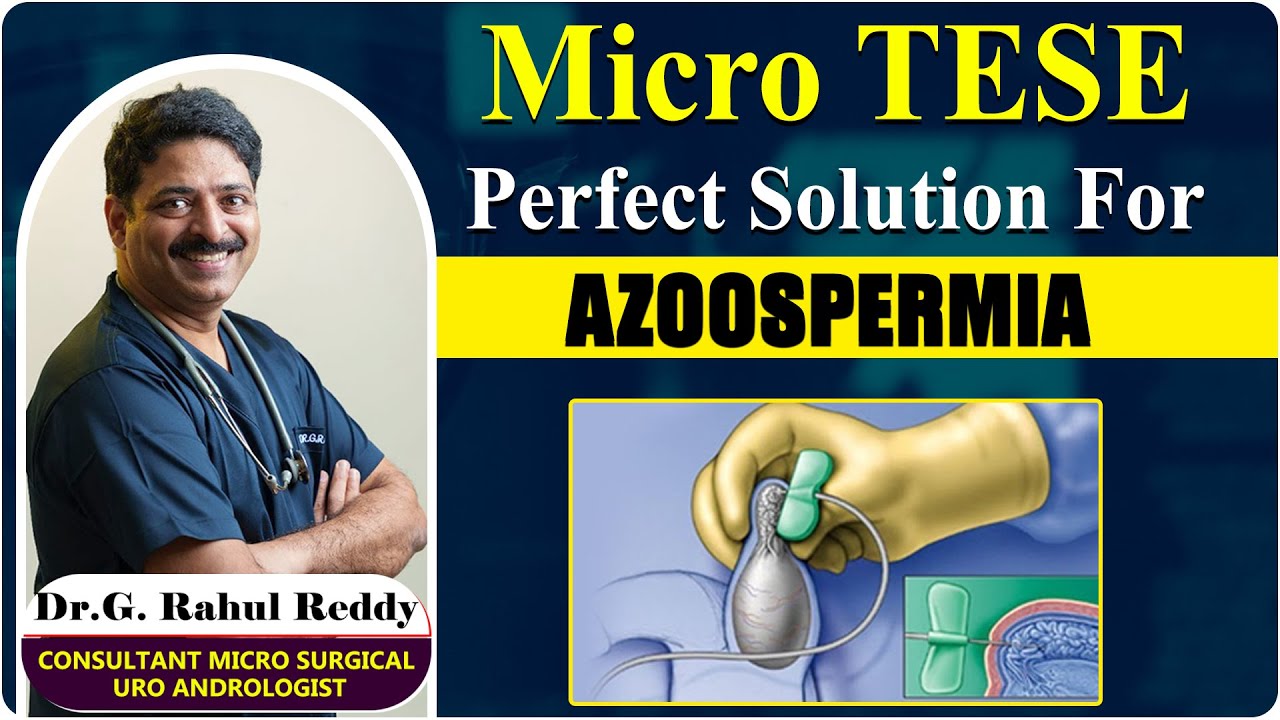 What is Micro TESE Best Surgerical Treatment Of Azoospermia Dr