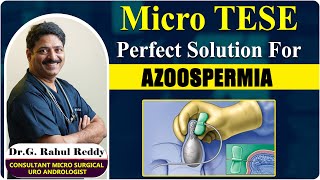 What is Micro TESE | Best Surgerical Treatment Of Azoospermia | Dr Rahul Reddy | Androcare Institute