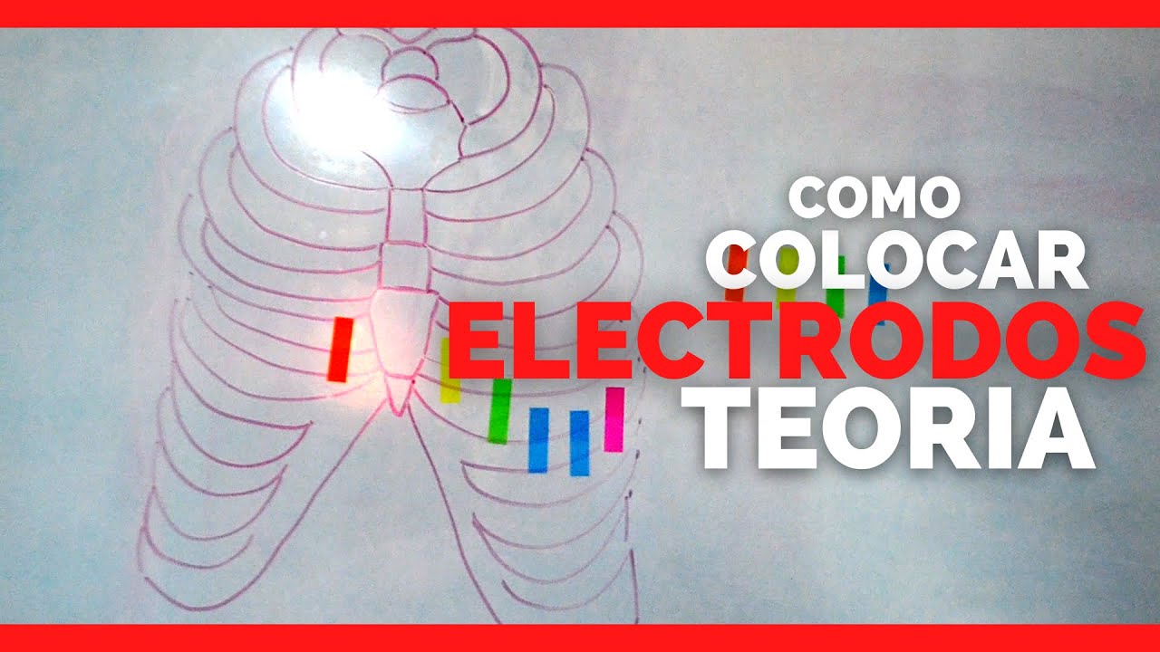 Electrocardiograma convencional