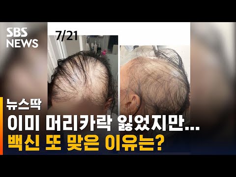 &amp;quot;이미 머리카락 잃었는데&amp;quot;…<strong>일본</strong> 20대 여성, 백신 2차 <strong>접종</strong> / SBS / 뉴스딱