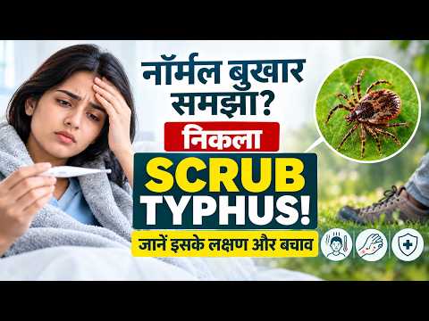 सामान्य बुखार समझकर किया नजरअंदाज, 20 साल के छात्र की मौत; जानें क्या है Scrub Typhus I OMH