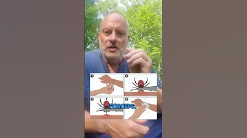 How to Remove a Tick