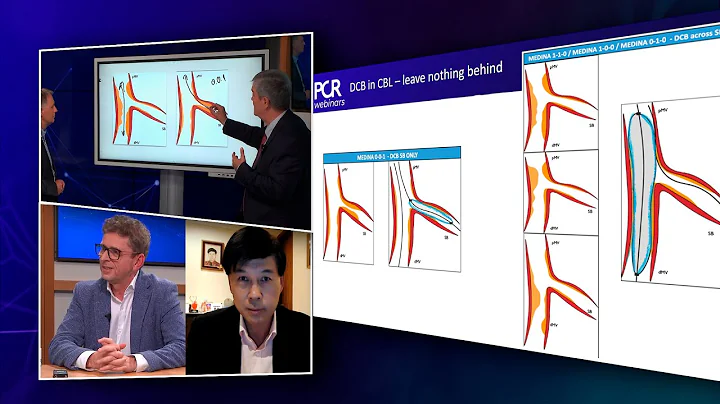How to use DCB in coronary bifurcations - Webinar