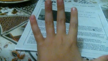 SCP Secure.Contain.Protect. (SCP 173 убил)