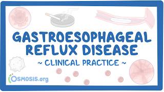 Gastroesophageal Reflux Disease