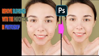 Get Flawless Skin: How to Remove Blemishes with the Patch Tool in Photoshop