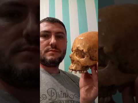 Человеческий Череп в