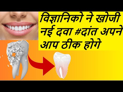 वीडियो: दंत चिकित्सक के पास कैसे जाएं: 14 कदम (चित्रों के साथ)