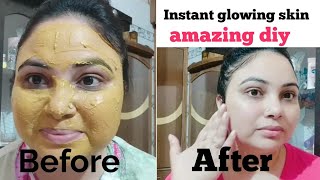 बेसन को इस तरह लगा के देखो चेहरा गुलाब की तरह खील जाएगा|besan multani mitti facepack fr glowing skin