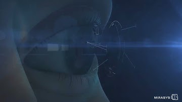 Chain snatching (Mirasys Deep Learning Artificial Intelligence)