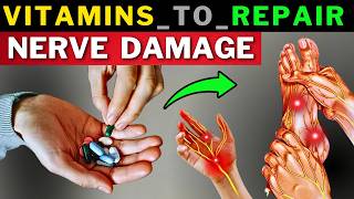 Top 7 Vitamins to Repair Nerve Damage