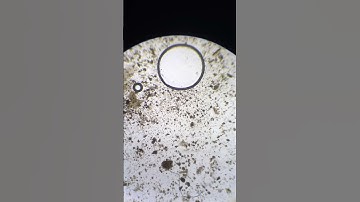 Shrimp 💩 “Vein” Under Microscope #science #microscopy #microscope