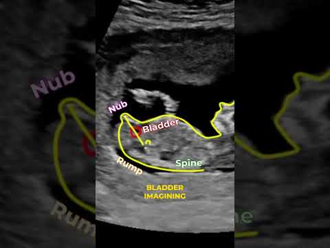 Curious About Your Baby S Gender Let S Find Out