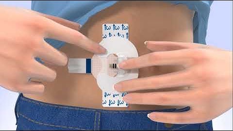 How to Tape Your Guardian™  Sensor 3