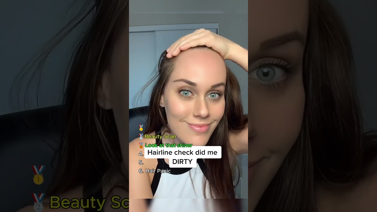 Top 6 Funniest Bad Hairline Check Fails – Funny Hairline Check Compilation