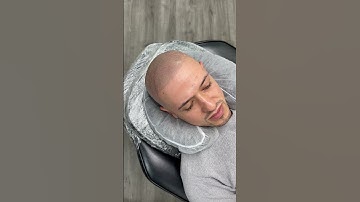 The Most Amazing Transformation! On Point SMP Los Angeles 🔥  #scalpmicropigmentation #hairloss