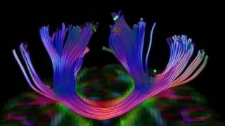Celebrity Brain Fiber Tractography Net Worth