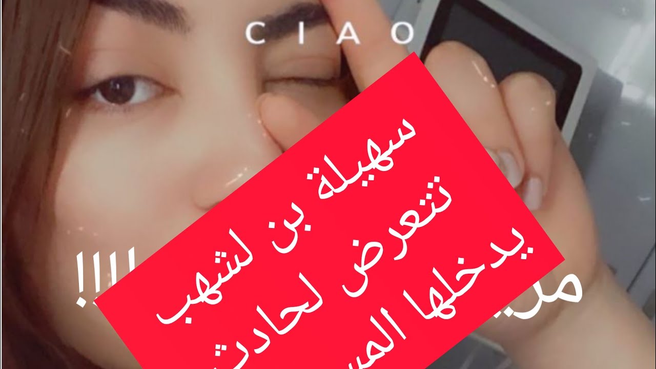 الفنانة الجزائرية 🇩🇿 سهيلة بلشهب تتعرض لحادث اقعدها عن المشي