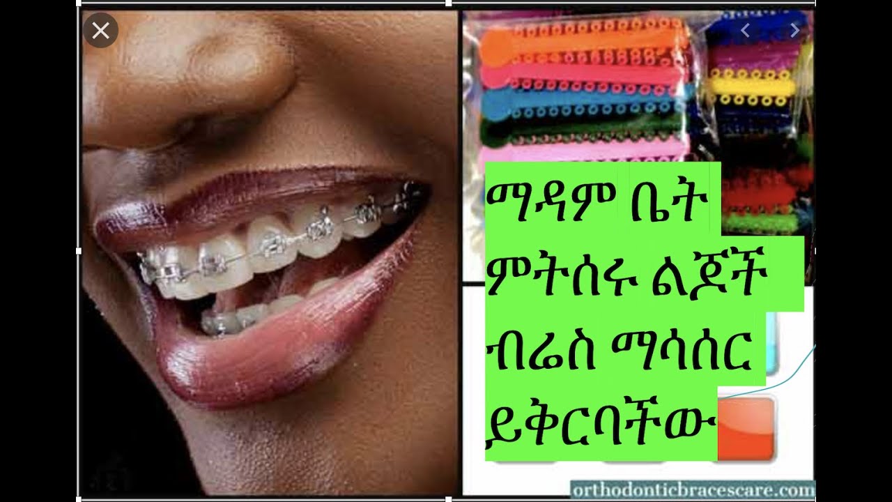 brace/ማዳም ቤት ምትሰሩ ልጆች   ብሬስ ማሳሰር ይቅርባችው  HD 1080p
