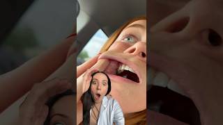 Dental Hygienist Reacts To A Seed Stuck Inside Of Someones Cheek 