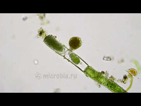 Video: Ameba Pod Mikroskopom - Patogena Ameba (pod Ameba) Pogosta