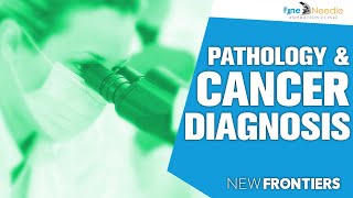 Fine Needle Aspiration Clinic in Pathology and Cancer Diagnosis 1 Minute Version